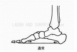 足底腱膜のアーチサポート.jpg