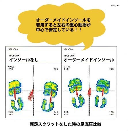 インソールによる両足スクワットの安定性.jpg