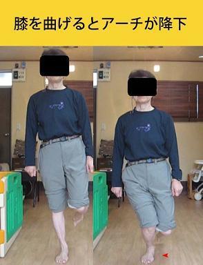 右片脚スクワット_外反母趾.jpg