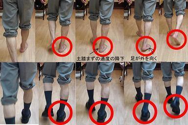 足関節の比較mini.JPG