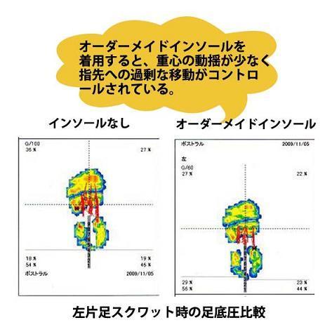 インソールによる左片足スクワットの安定性.jpg