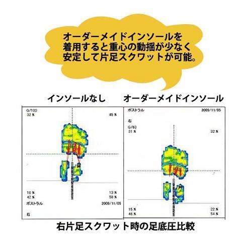 インソールによる右片足スクワットの安定性.jpg