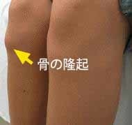 膝の痛み2.JPG