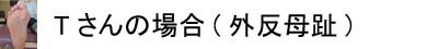 インソール実例集外反母趾.jpg